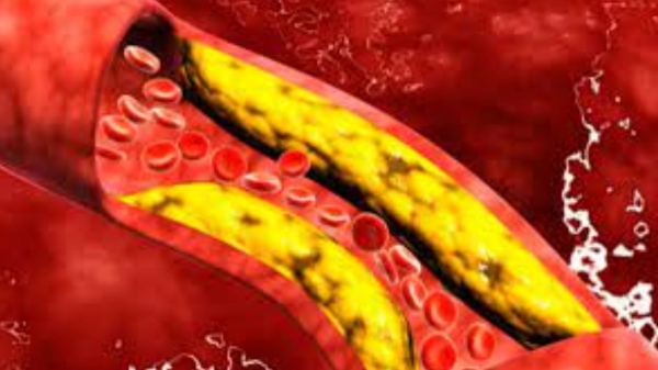  Do you know Excellent benefits of Garlic Juice and Garlic is the Best food for Healthy Liver