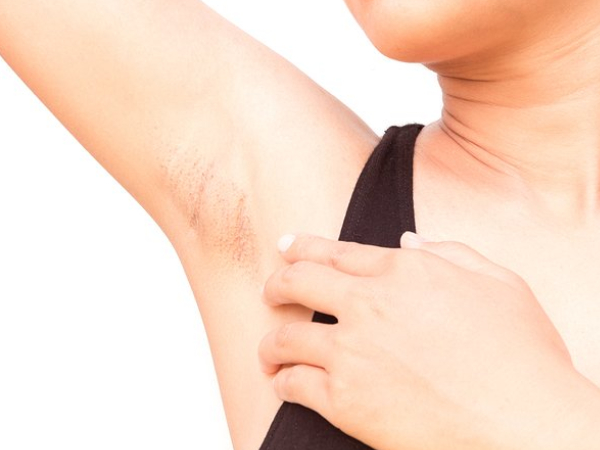 Do you know Excellent Health Benefits of Garlic and what are the Best home remedies for Armpit Lumps