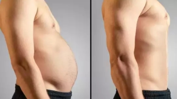 AIIDS: Do you know what is HIV virus and what are the signs symptoms of HIV, AIDS AIIDS: Do you know what is HIV virus and what are the signs symptoms of HIV, AIDS