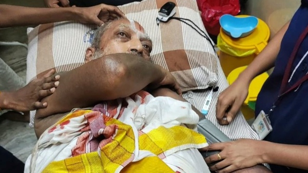 Police refuses that elder man in Triplicane died of cow hit 
