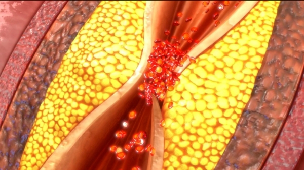 Do you know the Amazing Benefits of Brinjal and Best foods reduce High Cholesterol