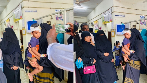 3 dogs bite a 3 year old child who was at home in Adirampattinam 3 dogs bite a 3 year old child who was at home in Adirampattinam