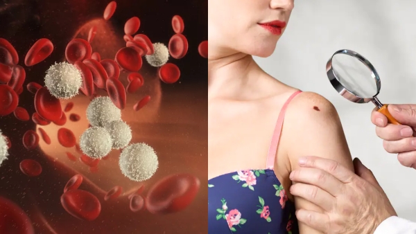 Do you know the Amazing Benefits of Fish and What are the General Symptoms of Cancer 