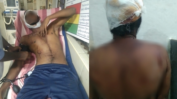  Dalit severly attacked in Pudukottai by casteists during diwali
