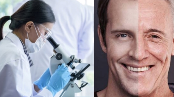  How researches made Age-reversal possible just with Pig plasma treatment