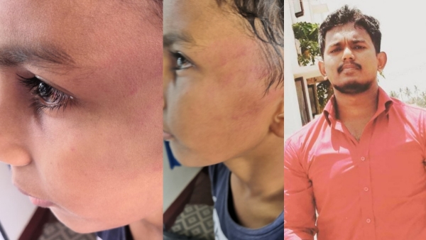 In a private school in Madurai K.Pudur, a 6th class student was brutally assaulted by the school administrator Shaheed for not wearing shoes 