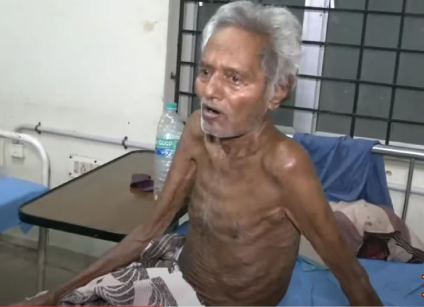 Rajiv Gandhi Government Hospital has a rehabilitation ward for the destitute