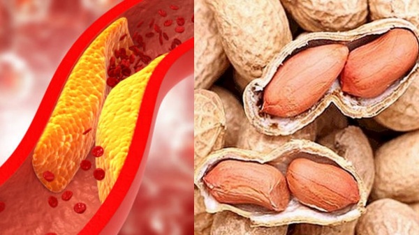 Do you know the Health Benefits of Peanuts and Ground Nut is the Best Tips for Weight Loss
