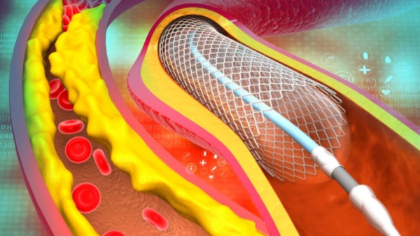 Do you know Health Benefits of Ghee and 6 Super Health tips for Weight Loss Do you know Health Benefits of Ghee and 6 Super Health tips for Weight Loss