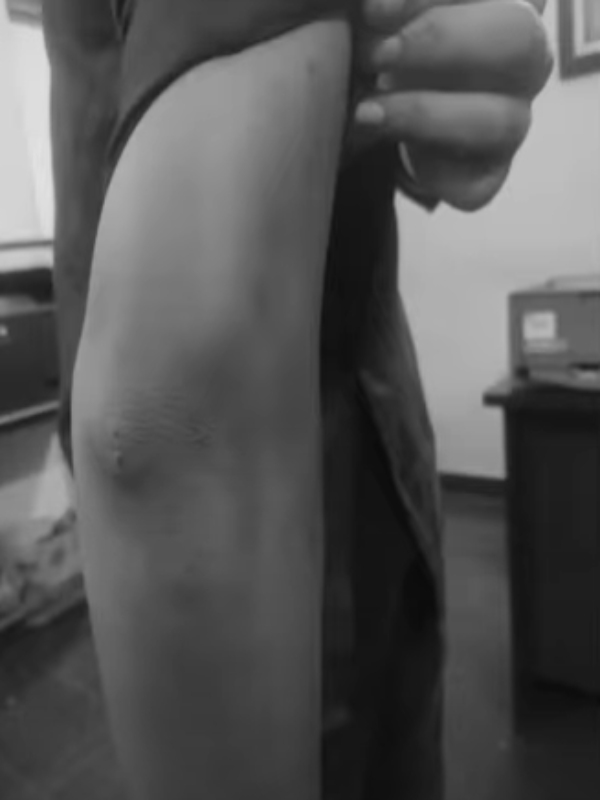 What happened in Coimbatore PSG College ragging? 