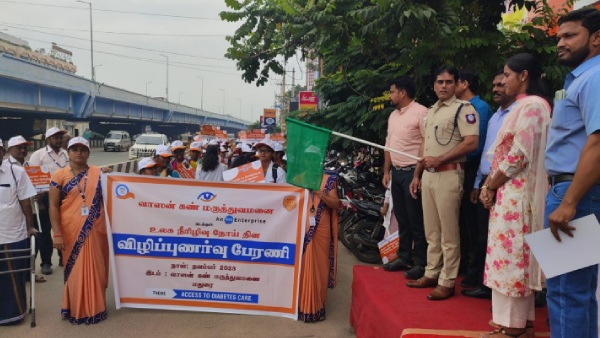 Eye damage in diabetic patients Vasan Eye Care Hospital announcement Free retinal examination Eye damage in diabetic patients Vasan Eye Care Hospital announcement Free retinal examination