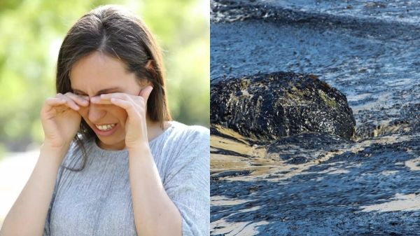 Crude oil spread at Ennore People suffer itching, eye irritation 