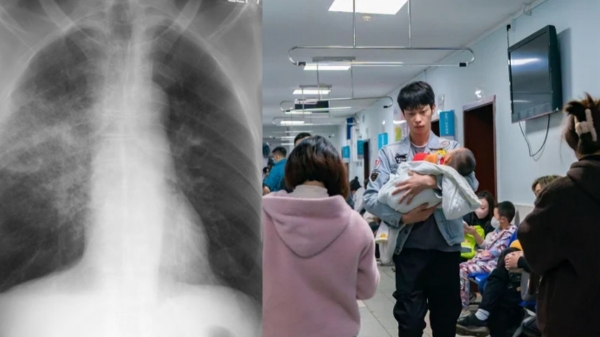  What Is White Lung Syndrome? This could be the answer to Chiba Mysterious Pneumonia Outbreak