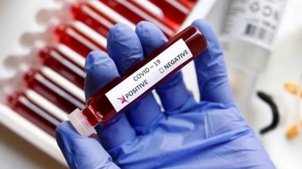  Two Infants aged 2 and 14 months test positive for Coronavirus in Hyderabad