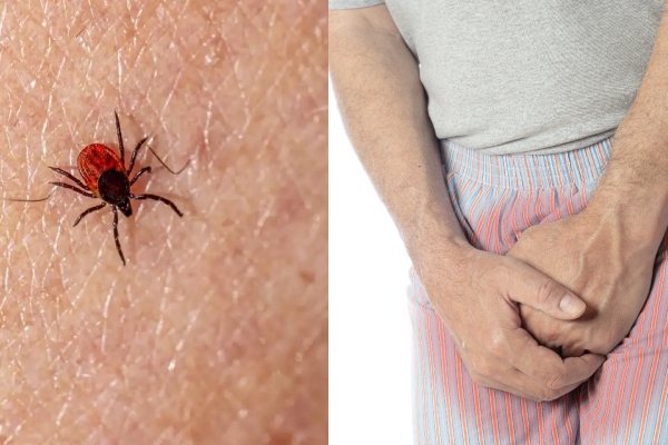  Why the Priest Cuts Off His Genitals With Knife After Tick Bite