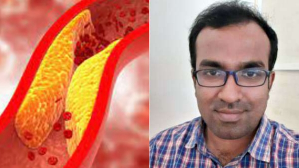 How heart vessels gets blocked? says Dr Farook Abdulla How heart vessels gets blocked? says Dr Farook Abdulla