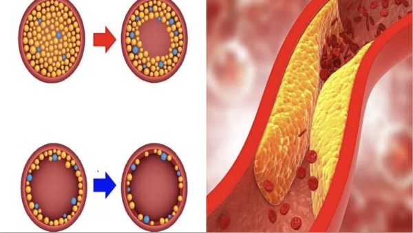 Do you know the Excellent Health Benefits of Poha and Amazing Medicinal uses of Red Poha for Diabetics