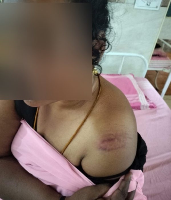 A casteist attack has been carried out on a Scheduled Caste medical worker in Madurai