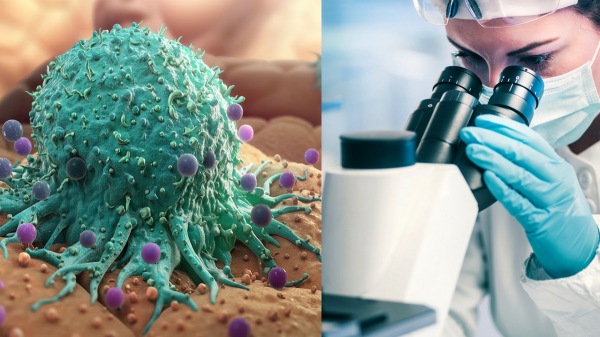 UK Scientists finds Breakthrough in Deadly Cancer treatment with New Drug UK Scientists finds Breakthrough in Deadly Cancer treatment with New Drug