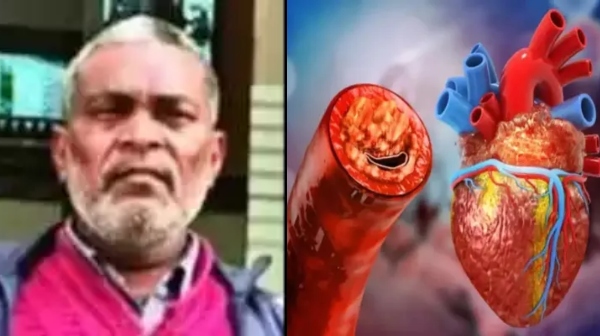 Ayurvedic therapy has cured the Heart blockage of 50-year-old man in Delhi Ayurvedic therapy has cured the Heart blockage of 50-year-old man in Delhi