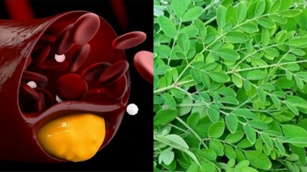 Do you know the Amazing Health Benefits of Curry Leaves and what are the Super Iron content food to cure anemia Do you know the Amazing Health Benefits of Curry Leaves and what are the Super Iron content food to cure anemia
