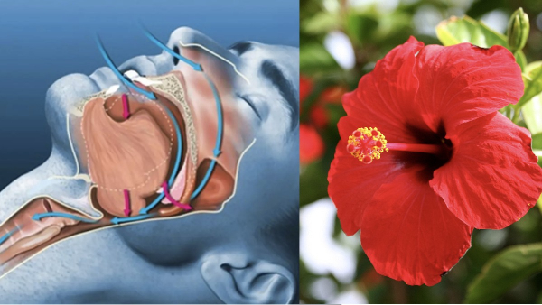 Do you know the Excellent Health Benefits of Hibiscus and What are the Super home remedies to avoid snoring