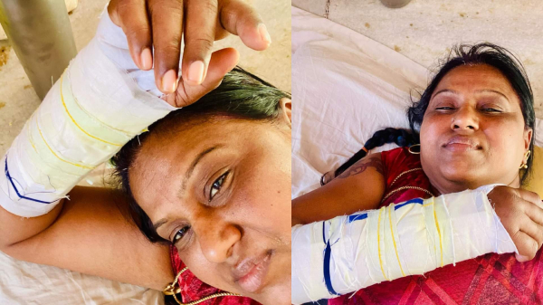 Baakiyalakshmi serial selvi Kambam Meena had an accident