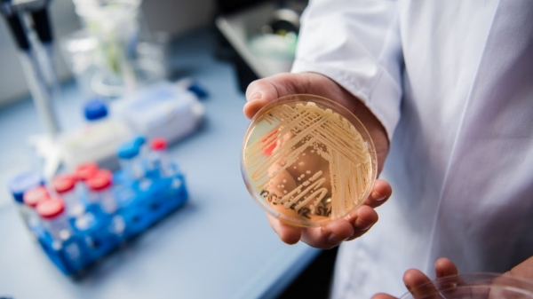 In US deadly Fungal Infection Candida Auris Spreading over the nation 