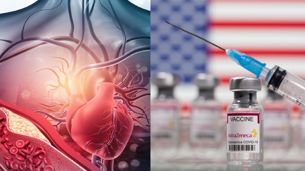 Corona vaccination is causing blood clots, heart inflammation says Global studies 