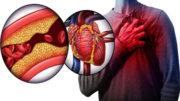 How Laser technology is used to vaporuize blockages inside heart vessels