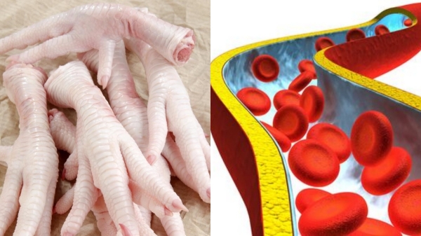 Super Health Medicine in Mutton Leg and Fantastic Chicken Leg is the Best food for Heart Patients