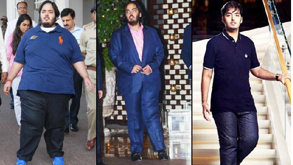 What is the Mukesh Ambani younger son anant ambani health history