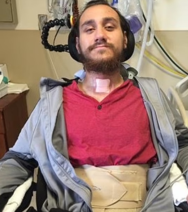 Elon Musk Neuralink first patient post his first twitter post Just By Thinking