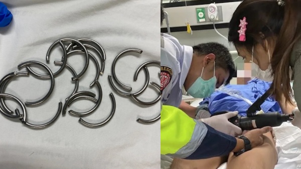 Bizzare incident man in Thailand Rushed to hospital after attempting to put 11 Rings in his private parts