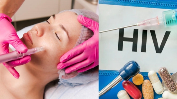 3 women contracted HIV through a vampire facial at spa in US