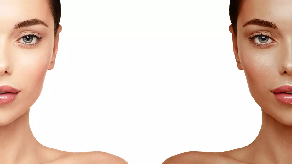 How to Protect Your Skin And Avoid Tanning This Summer