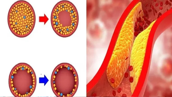 Which Health helps to reduce Bad cholesterol and White Pumpkin Juice is the Amazing Medicinal food for Weight Loss