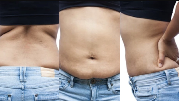 Amazing Health Benefits of Cumin Water and Do you know what are the Best tips to reduce your belly fat Amazing Health Benefits of Cumin Water and Do you know what are the Best tips to reduce your belly fat