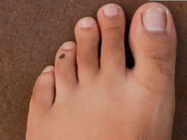 Personality test Do you know your foot shape tells about ur personality Personality test Do you know your foot shape tells about ur personality