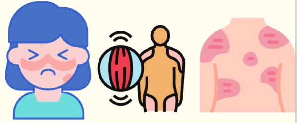 What is the remedy for summer skin diseases