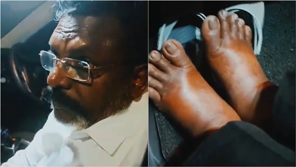 Vck candidate Thirumavalavan campaigning in Chidambaram constituency swollen leg