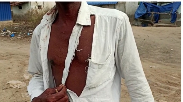 AIADMK booth agent was attacked by youths who tore his shirt in ramanathapuram AIADMK booth agent was attacked by youths who tore his shirt in ramanathapuram
