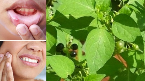 Can we apply Butter for Mouth Ulcer and what are the Symptoms for Mouth Wound Are these Best home remedies