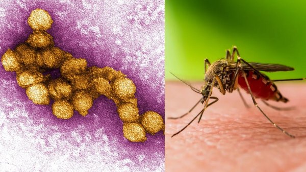 Dr Farook Abdulla says about West Nile Virus