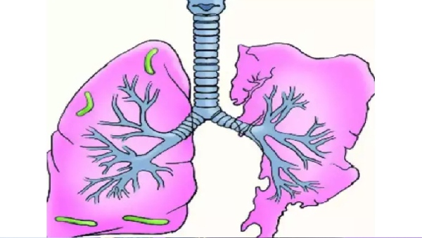 Do you know Medicinal Benefits of Cabbage and what are the Best Food to protect the Lungs Healthy Do you know Medicinal Benefits of Cabbage and what are the Best Food to protect the Lungs Healthy