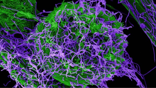 Chinese scientists create and testing new type of Ebola virus that causes severe damage Chinese scientists create and testing new type of Ebola virus that causes severe damage