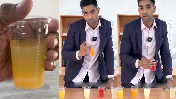 One can say the health issue by checking the urine colour One can say the health issue by checking the urine colour