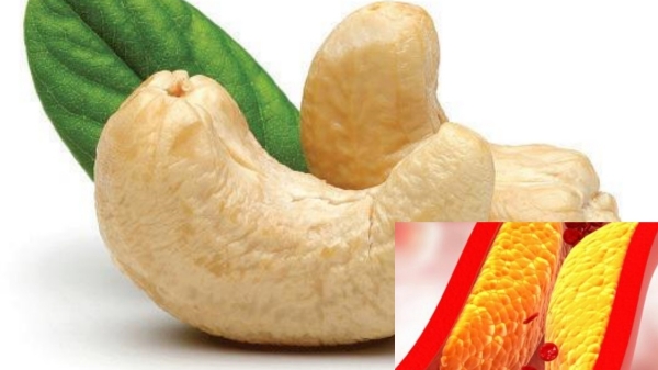 Health Health news Health tips cashew Nuts