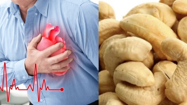 Health Health tips Cashew Nuts cashew nuts Diabetics Sugar Patients Health Health tips Cashew Nuts cashew nuts Diabetics Sugar Patients