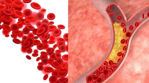 Health Health news Health tips Watermelon Belly fat